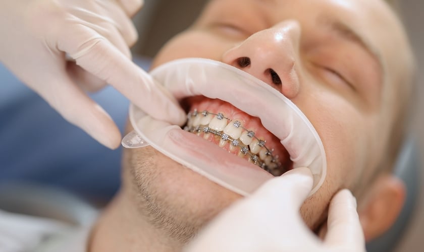 What Does an Orthodontist Do?
