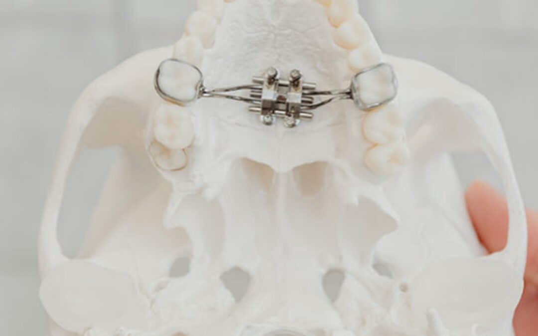 Airway Orthodontist in Denver, Colorado