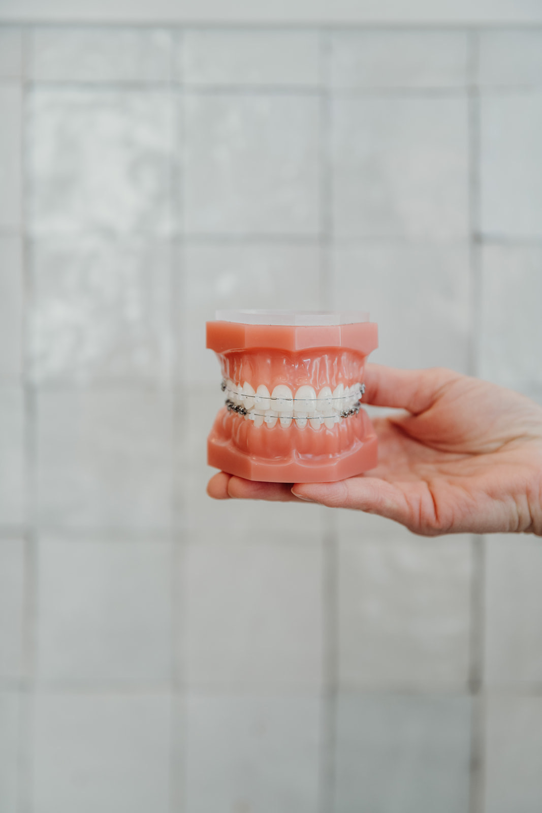 Clear ceramic braces on a dental model held by an orthodontist at Aligned Orthodontics in Denver