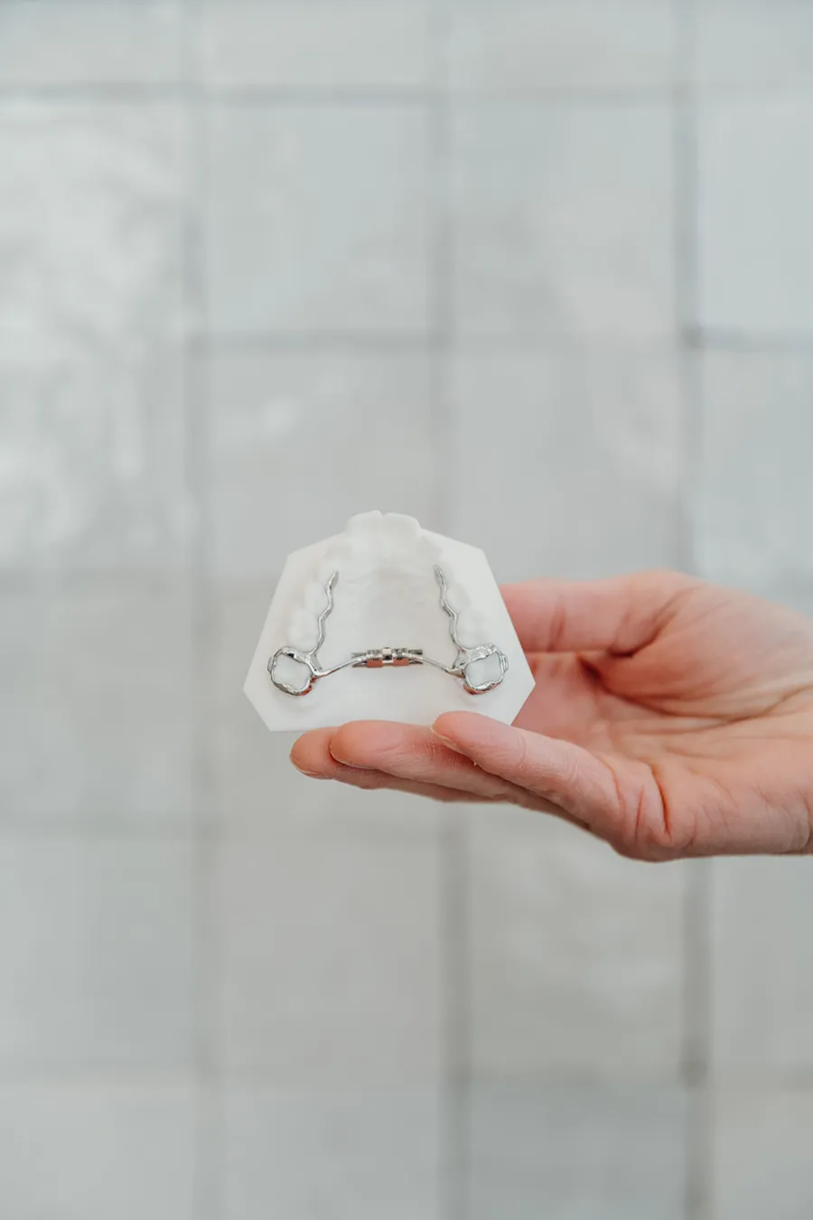 Hand holding a palatal expander used in early orthodontic treatment for kids