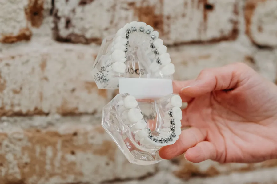 Clear teeth model showing lingual braces attached to the backs of the teeth